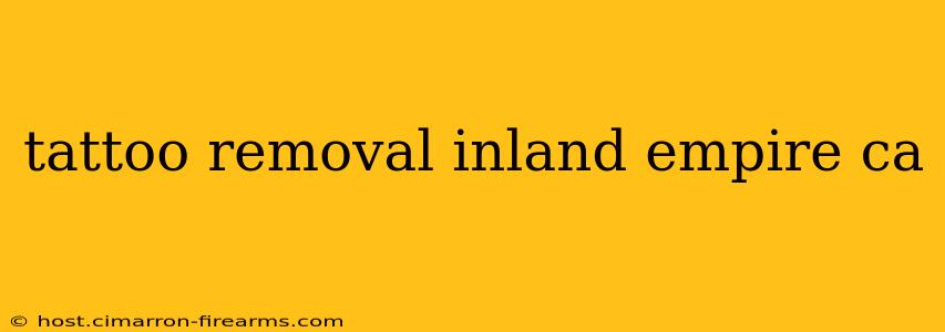 tattoo removal inland empire ca